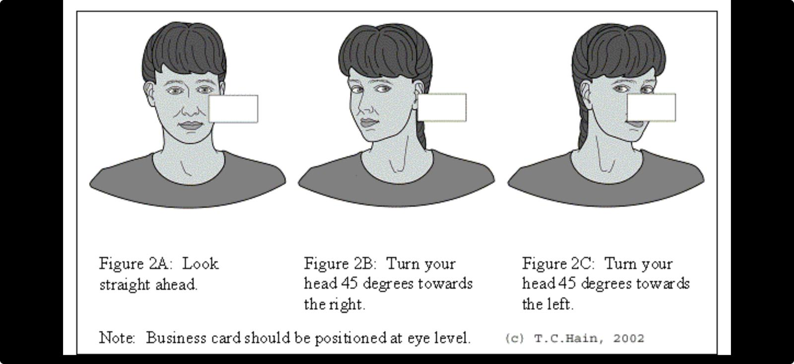 Concussion physiotherapy
